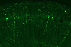 Tau Proteins in the Hippocampus