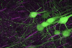 Cluster of layer 5 pyramidal neurons marked for ankyrin G