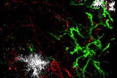 Amyloid plaques and reactive glia in the cortex of 5xfad Alzheimer's disease mouse model