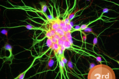 Hippocampal neurons immunostained with MAP2 (green), BDNF (red) and Dapi (blue) at 20x magnification with scale bars, 20 μm