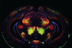 Coronal Brain Section Mouse