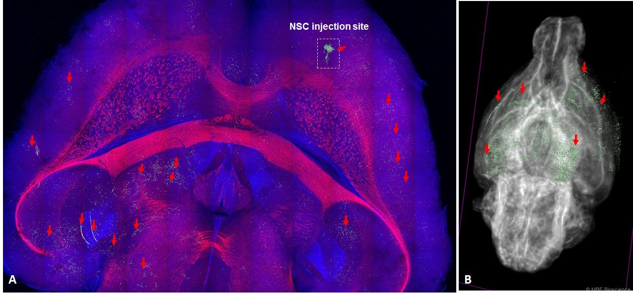 Engraftment, distribution and fate of LM-NSC008 cells in naive adult mouse brain in 3 Dimension