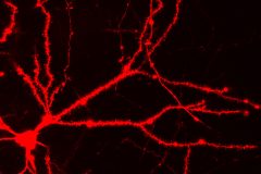 Pyramidal Neuron