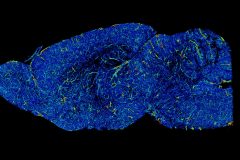 Sagittal slice of mouse cerebrovasculature