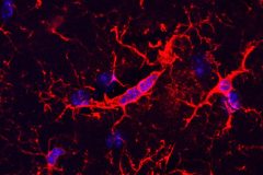 The Dividing Microglia