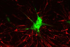 War against human glioblastoma