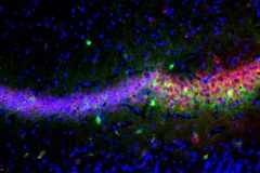 Hippocampal Rainbow Orchestrated by Parvalbumin Interneurons in the Mouse Brain