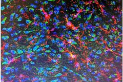 Microglia and human neurons