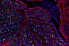 Fllower of the brain
