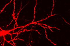 Pyramidal Neuron