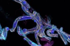 20250804-Microvessel-IF-trial-3_Fixed-well-6-image-1Snapshot5_ch00