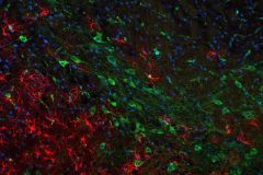 Neuroinflammation in the substantia nigra