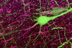 Neuronal electrical storm