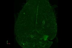 962_EcoHIV-14d_eGFP