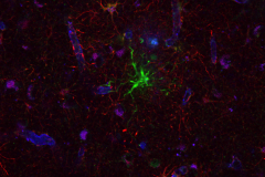 Astrocytic subpopulations in the human brain