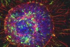 Astrocytes expressing toxic ALS protein aggregates