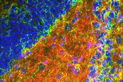 Cannabinoids on the brain