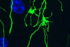Huge Neuronal Synapse