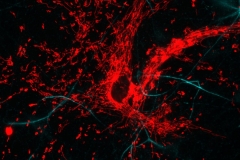 Mitochondria of an astrocyte