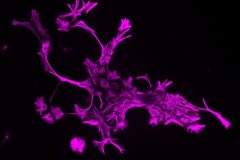 Astrocytes Dancing in the Darkness