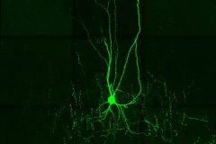 Chandelier neuron