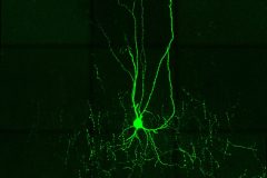 Chandelier neuron