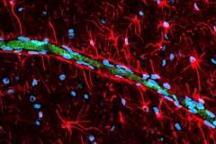 Blood brain barrier in the monkey brain