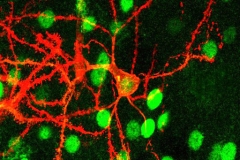 Rat dorsal striatum medium spiny neuron