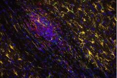 IHC staining of an EAE (model of multiple sclerosis) lesion in a murine spinal cord