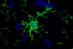Microglia glow green with Iba1 staining