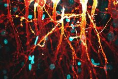 CA1 Pyramidal Neurons Labelled with DiI