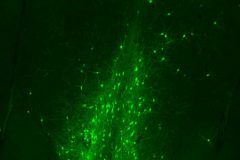 The septal galaxy