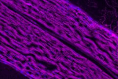 Longitudinal Imaging of the Mouse Sciatic Nerve