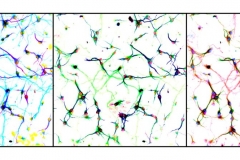 Neurons à la warhol