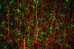 Brain Forest