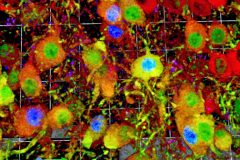 Calbindin-expressing dopamine neurons derived from the wnt1 lineage