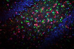 Friends or foes: the glia dilemma