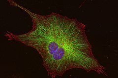 Mouse cortical astrocyte