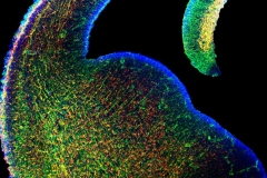 Inside a mouse embryo brain