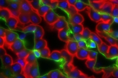 Choroid epithelial cells (red)