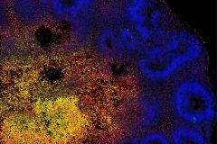 Epigenetic dynamics of 5hmC/5mC in cerebral organoid