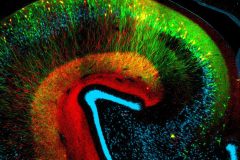 Rainbow in the Hippocampus