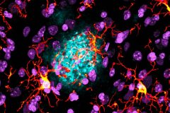 Busy Microglia Cleaning Up the Amyloid Buildup in the Aged Brain