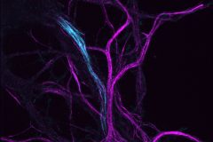 Hippocampal Explosion