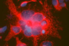 Neuroblastoma cells with lots of mitochondria