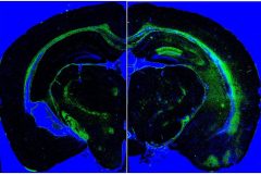 FluoroJade C Staining for Degenerating Neurons