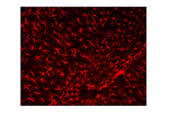 Astrocytes in hippocampus region of mouse brain stained with GFAP antibody