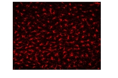 TSPO positive micoglial cells in hippocampus