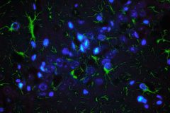 You have been skeletonized! A radiography of an astrocyte