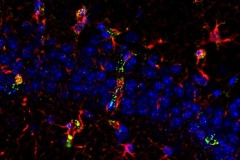 Production of TNF-alpha by astrocytes in the CA1 region of the hippocampus.